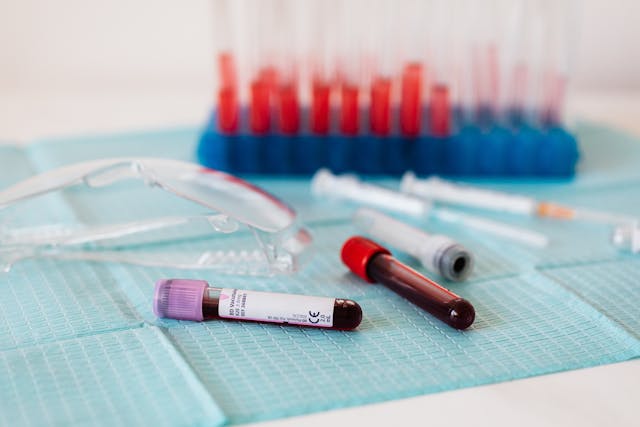 Vivre avec la drépanocytose en Guinée : entre stigmatisation, résilience et solidarité
